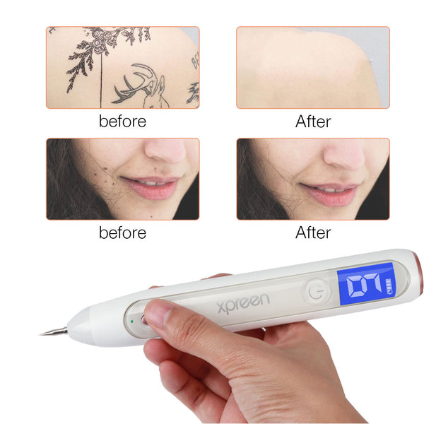 Skin Tag Remover Pen, Mole Wart  Remover Pen, Dark Spot Remover, Boho Beauty Gadgets